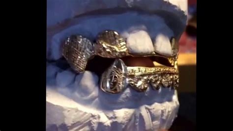 Versace Grillz 